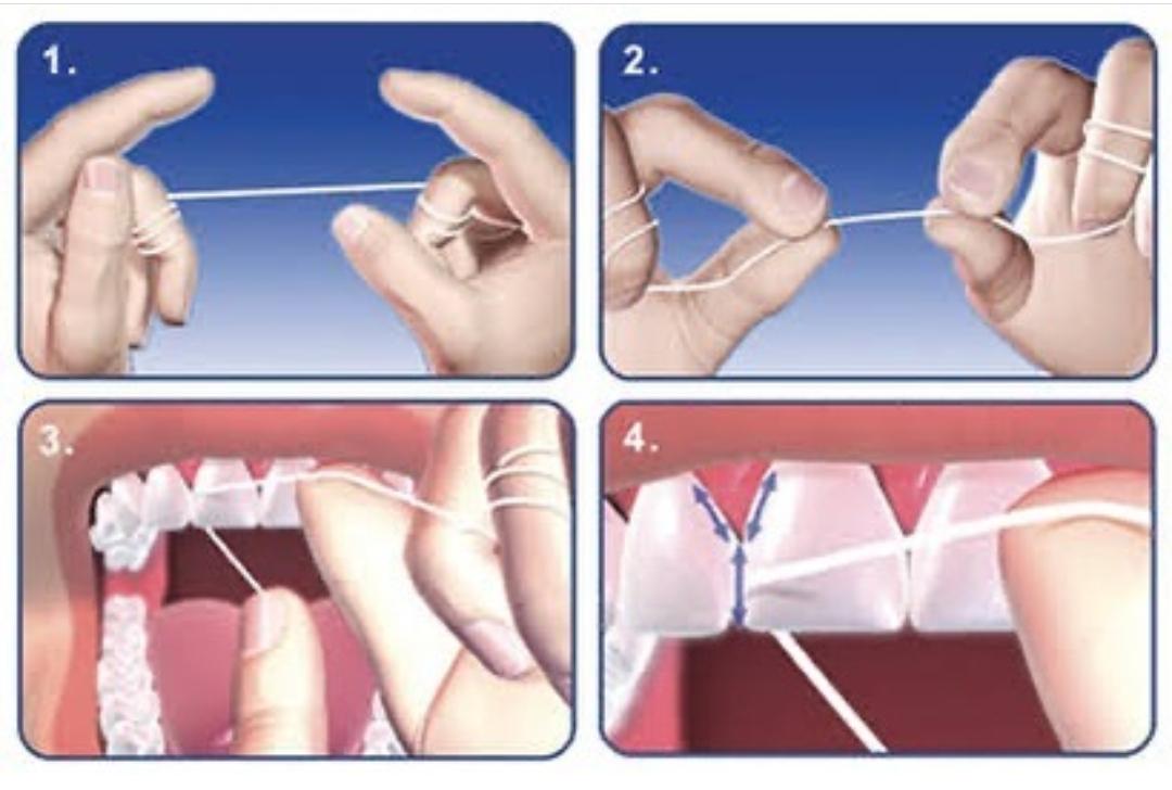 MY DENTIST DENTAL AND ORAL HYGIENE CENTRE POOVATTUPARAMBA