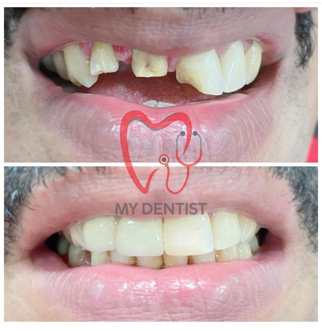 MY DENTIST DENTAL AND ORAL HYGIENE CENTRE POOVATTUPARAMBA