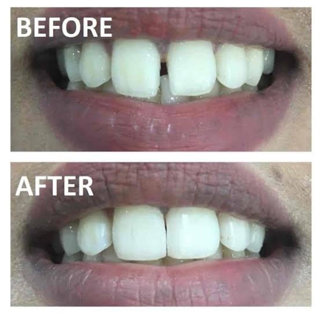 MY DENTIST DENTAL AND ORAL HYGIENE CENTRE POOVATTUPARAMBA